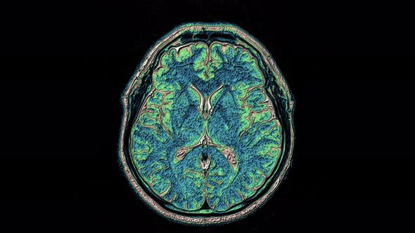 Bulk Multicolored MRI Scans of the Brain and Head To Detect Tumors. Diagnostic Medical Tool