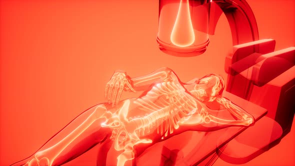 X-ray Examination Medical Scan Footage alt