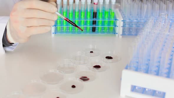 Close Up Footage of a Researcher's Hands Dripping a Blood Samplesin a Petri Dishes. Modern