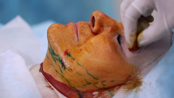 Closeup Picture of Adult Woman Lying on Table in Operating Room with Closed Eyes While Paramedic