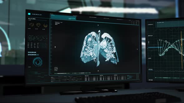 High Tech Cancer Treatment Medical Software Interface Scanning Human Lungs Organ alt