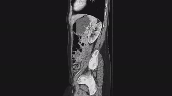 Voluminous MRI of the Female Pelvic Organs, Abdominal Cavity, Gastrointestinal Tract and Bladder