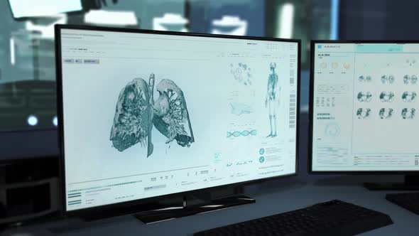 Spreading Cancerous Illness Detected By Modern X-ray Scanner Device Software alt