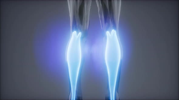 Gastrocnemius- Visible Muscle Anatomy Map alt