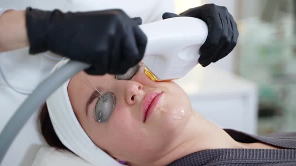 Improving Facial Skin Condition with BBL Laser at Cosmetology Clinic