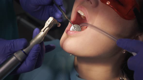 Dentist Is Taking Care About Patient's Tooth Using Electric Dental Brush, Opening Patient's Mouth