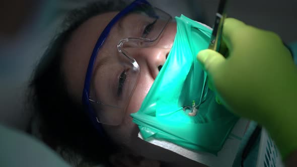 Closeup Dentist Pulling Out Root Canal Cleaning File with Tweezers in Slow Motion