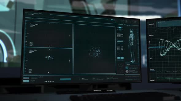 High Tech X-ray Scanner Device During Medical Brain Cancer Examination