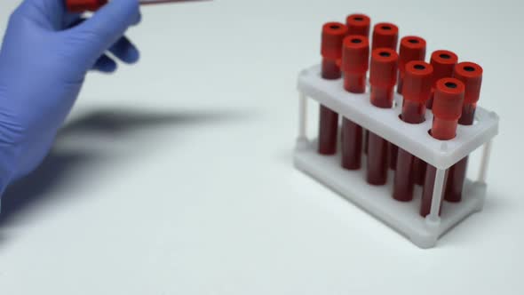 Positive EV71 Test, Doctor Showing Blood Sample