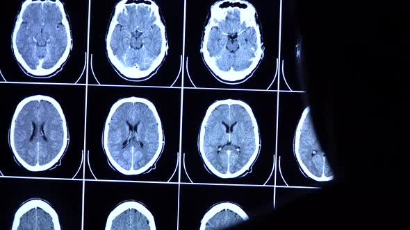 Medical scientist scrolls CT, MRI brain scan images on a big screen.