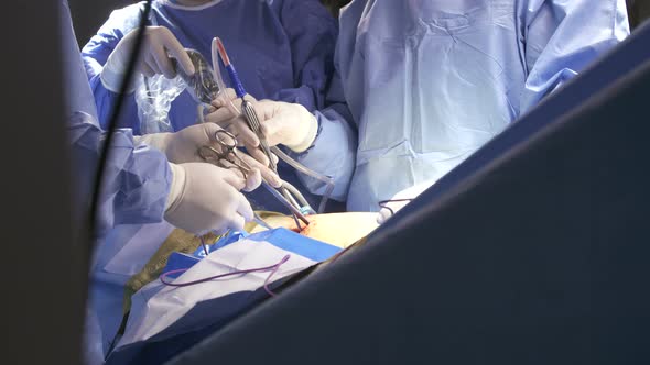 Surgeons working during surgery, close up on hands and instruments.