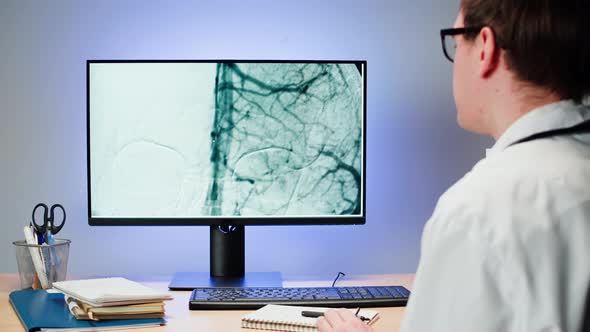 Doctor Examining Blood Vessels Xray on Computer Monitor