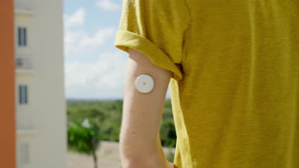 Young Adult Male Checking His Blood Glucose Levels On Left Arm With Freestyle Libre 2 Sensor. Close