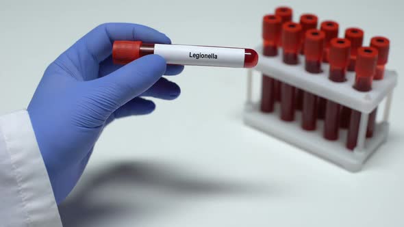 Legionella, Doctor Showing Blood Sample in Tube, Lab Research, Health Checkup