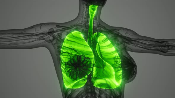 Science Anatomy Scan of Human Lungs