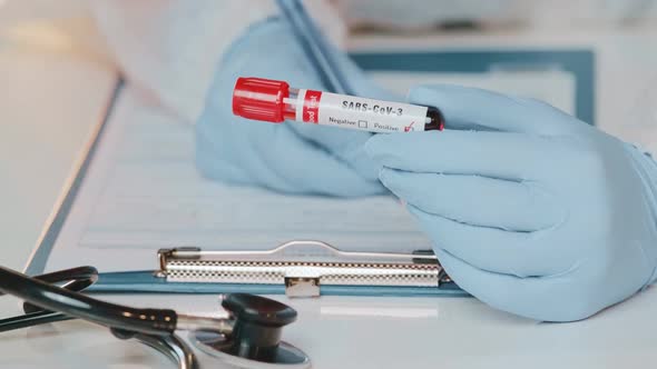 Close Up of Doctors Hand Holding Tube with Positive Blood Test for SARS-CoV-3