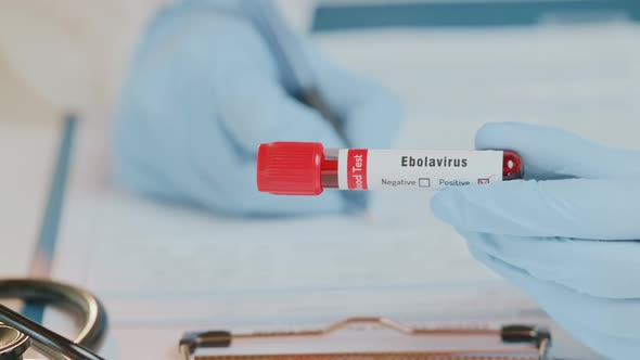 The Doctor Holds Hand Laboratory Positive Blood Test Tube for Virus Ebola