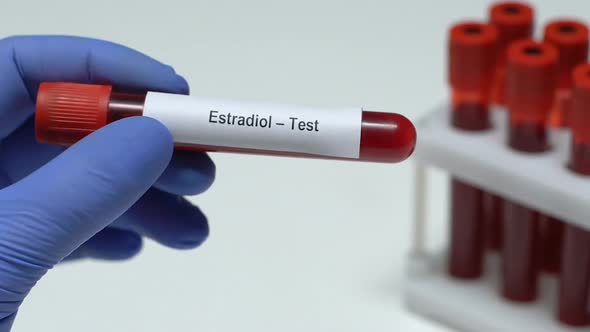 Estradiol-Test, Doctor Holding Blood Sample in Tube Close-Up, Health Check-Up