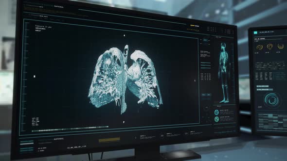 Modern Ct Scanner Researches Patients Dangerous Lung Organ Cancer Diagnosis alt