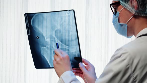 Doctor Examining Pelvis Hip Xray Closeup