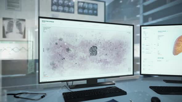 Animation of the infection microbe organism multiplication at the laboratory