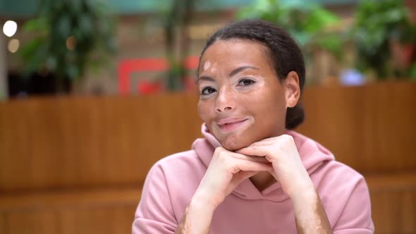 Black African American Woman with Vitiligo Pigmentation Skin Problem Indoor Dressed Pink Hoodie