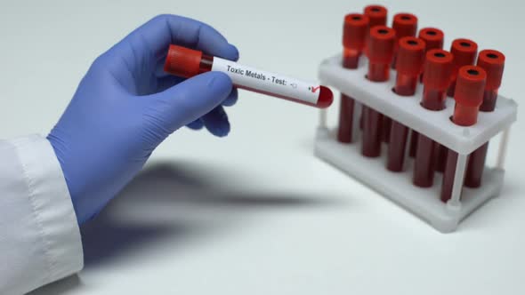 Positive Toxic Metals Test, Doctor Showing Blood Sample in Tube, Lab Research
