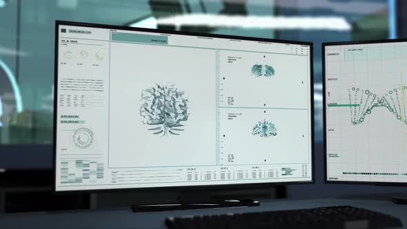 Modern X-Ray Examination Medical Interface Scans Brain On Multiple Screens alt