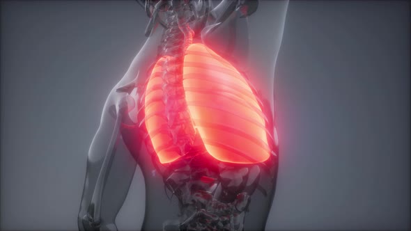 Human Lungs Radiology Exam