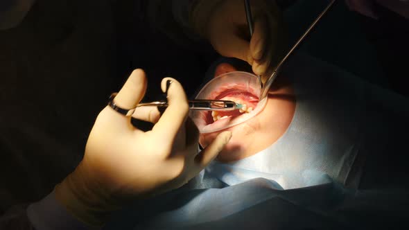 Dental Surgeon at Work