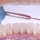 Dentist Inspects Teeth with Probe - VideoHive Item for Sale