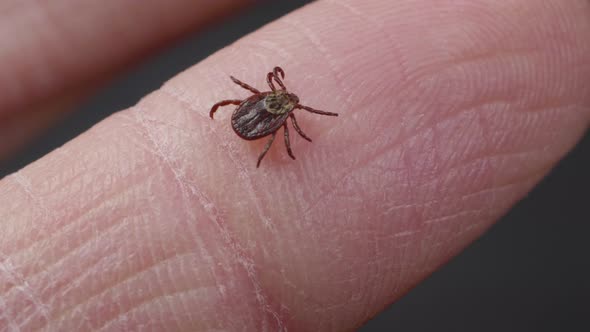 Blood-sucking Mite Tick Creepes on the Human Finger To Bite