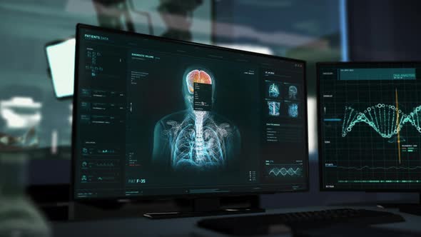 Detecting the brain tumor after the examination of the patient skull at the lab alt