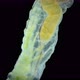 Worm Polychaeta of the Family Terebellidae Under the Microscope - VideoHive Item for Sale
