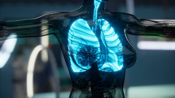 Human Lungs Radiology Exam in Laboratory alt