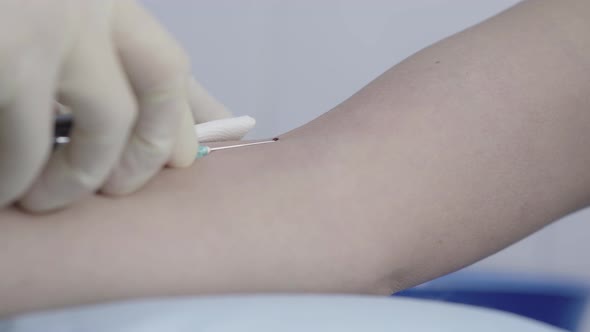 Extreme Close-up of Nurse Hands in Gloves Putting Napkin on Female Hand and Taking Out Syringe with