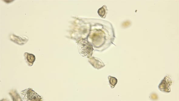 Colony of Plankton Rotifers Rotifera Under a Microscope