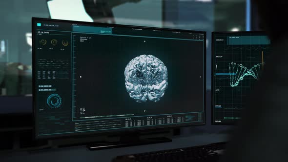 Brain Scan Analyzed In Advanced Medical Software At Neurosurgery Laboratory alt
