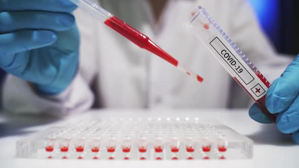 A Doctor Checks Blood Tubes for Coronavirus