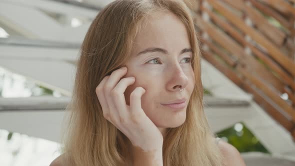 Pretty Young Woman with Vitiligo Pigmentation Sitting on the Stairs Looking at the Camera