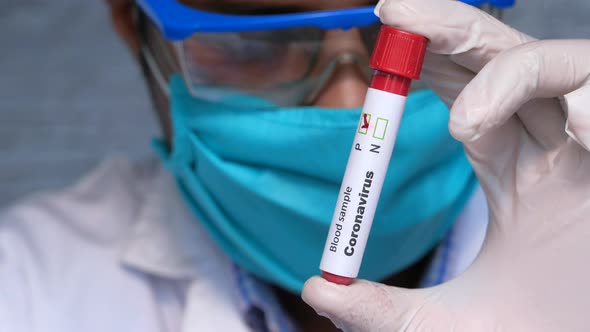 Close Up of Laboratory Technician Hand Holding Blood Test Tube 