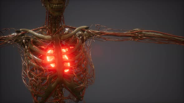 CG Animation Of A Sick Human Heart