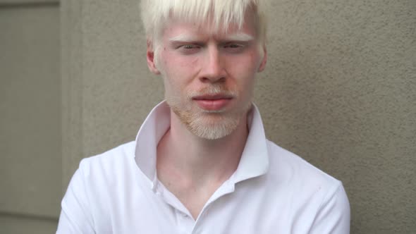 Portrait of An Albino Man Standing Outdoor 