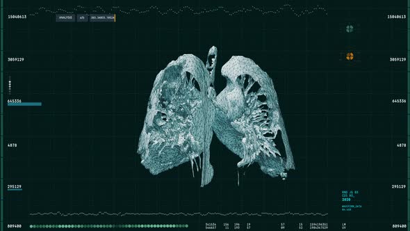 Epidemic Covid Infection Research By High Tech Medical Software Interface alt