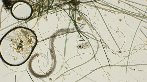 Nematode Worm Under a Microscope