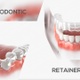 Orthodontic retainer - VideoHive Item for Sale