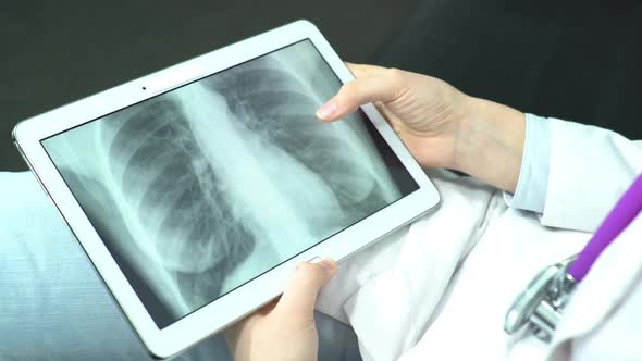 Doctor Controlling X-Ray on Tablet Computer