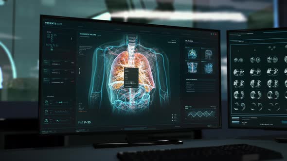 Scanner interface detects deadly lung cancer cells in the patient skeleton alt