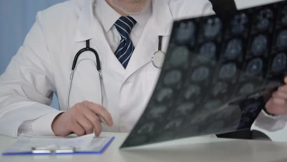 Doctor Scrutinizing Each Part of MRI Scan to See if There Is Reasons for Concern