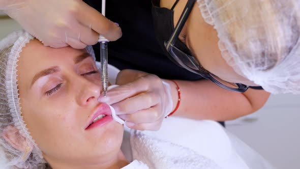 Woman Gets Beauty Injection for Her Lips. Surgeon, in Medical Gloves, Pierces Upper Lip with Syringe